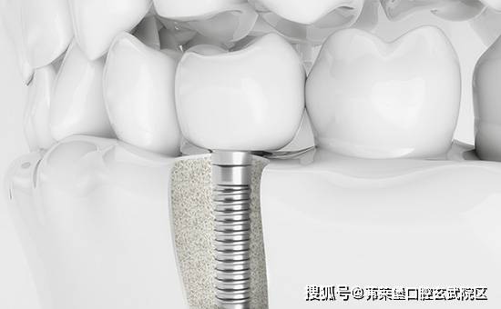 南京茀莱堡口腔热点资讯，新岁启新齿，口福自然来